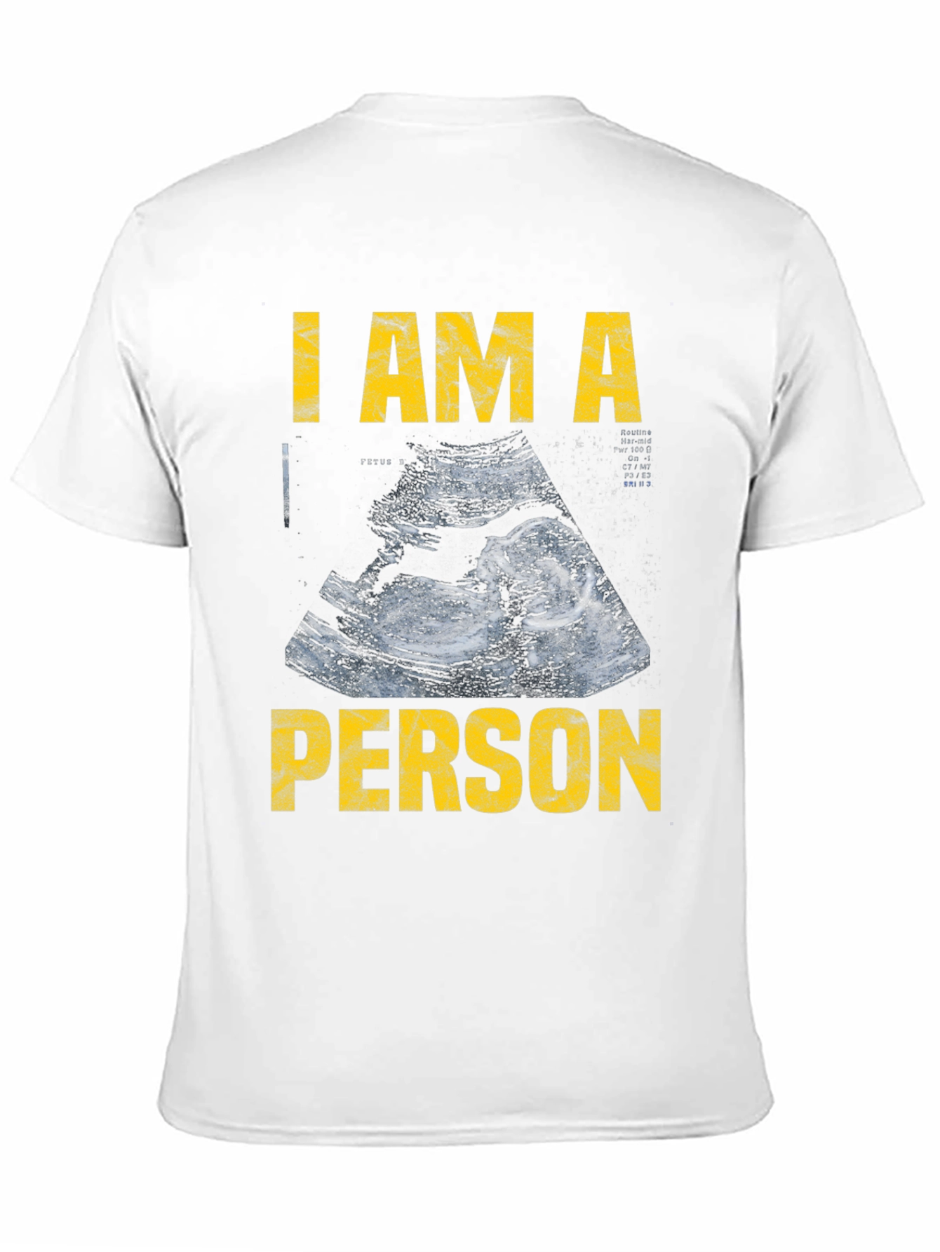 I Am A Person Pro-Life T-Shirt